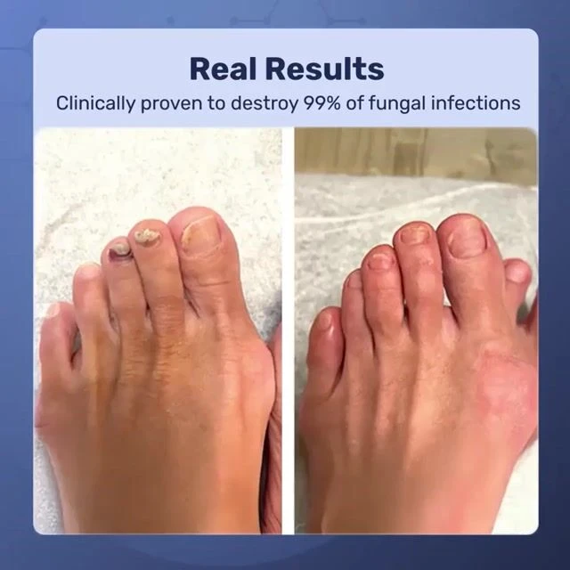 ClearaWella image