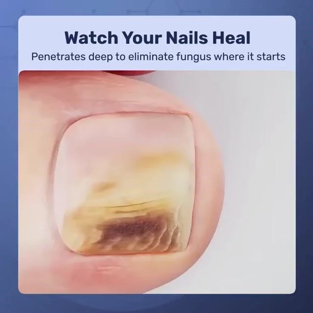 ClearaWella image